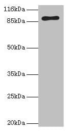 R1 / RRM1 Antibody