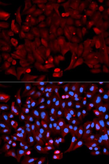 Polyclonal Rabbit anti-Human ANXA1 / Annexin A1 Antibody (IHC, IF, WB)
