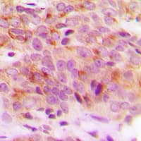 Polyclonal Rabbit anti-Human SNCG / Gamma-Synuclein Antibody (C-Terminus, IHC, WB)