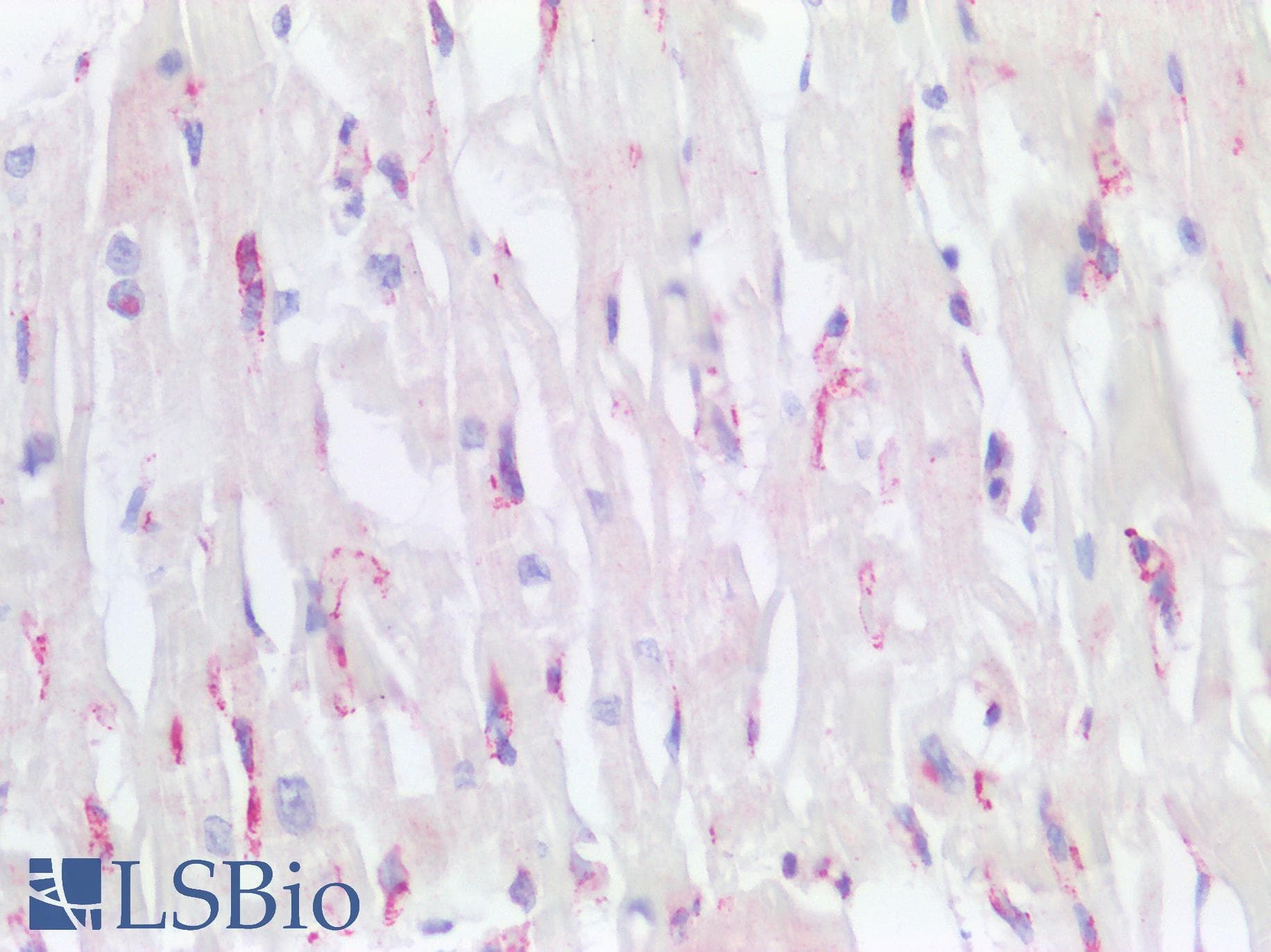 PathPlus™ NES / Nestin Antibody