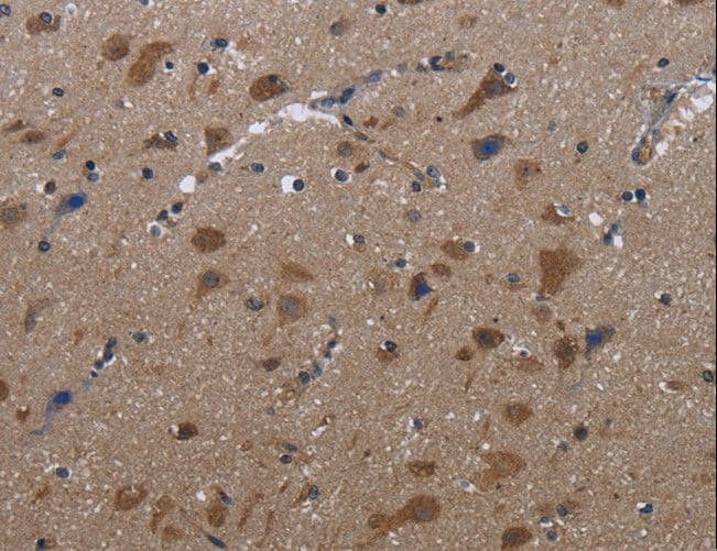 Polyclonal Rabbit anti-Human LETMD1 / HCCR1 Antibody (IHC)