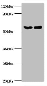 Polyclonal Rabbit anti-Human CSTF2 / CstF-64 Antibody (aa1-180, IHC, WB)