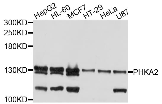 PHKA2 Antibody