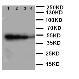 Polyclonal Rabbit anti-Human ALK-6 / BMPR1B Antibody (aa145-160, WB)