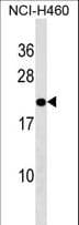 TMED10 / TMP21 Antibody (aa156-185)