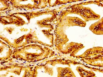 SLC45A3 / Prostein / p501S Antibody
