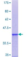 Human EDEM1 / EDEM Protein (Recombinant GST, N-terminus)