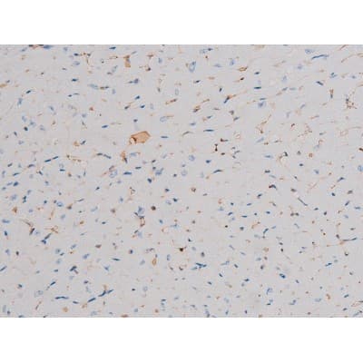 CDC25A Antibody (phospho-Ser178)