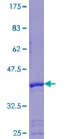 Human SHSF1 / SHFM1 Protein (Recombinant GST)