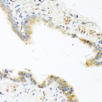 RETN / Resistin Antibody