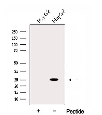 Polyclonal Rabbit anti-Human EVI2A Antibody (WB)