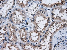 AKT2 Antibody (clone OTI4H7)