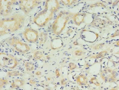 Polyclonal Rabbit anti-Human RNF183 Antibody (IHC)