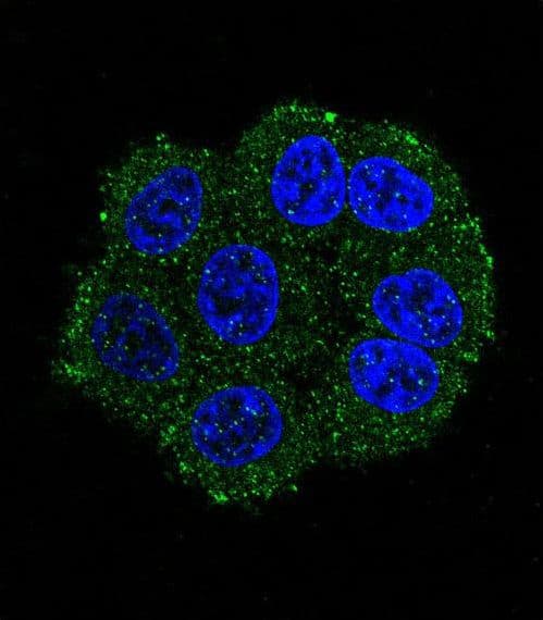 TMPRSS3 Antibody (aa272-300)