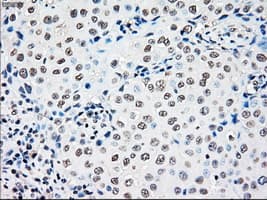 RAD9A / RAD9 Antibody (clone OTI7B11)