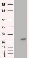 KHK / Ketohexokinase Antibody (clone OTI1F1)