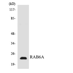 Polyclonal Rabbit anti-Human RAB6A / RAB6 Antibody (aa95-144, WB)