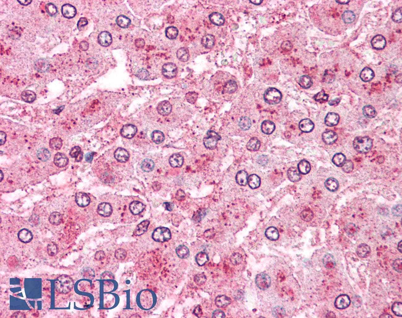 IHC-plus™ Polyclonal Rabbit anti-Human ARTS1 / ERAP1 Antibody (Internal, IHC)