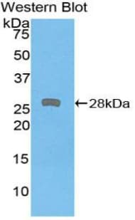PRKD2 / PKD2 Antibody (aa621-832)