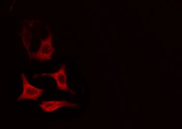 Cytochrome P450 2R1 / CYP2R1 Antibody
