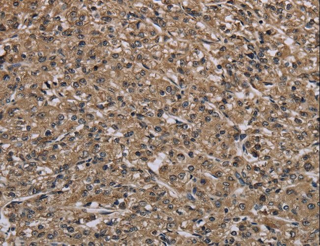 MYO18B / Myosin 18B Antibody