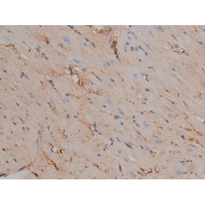 MAPT / Tau Antibody (phospho-Ser404)