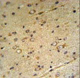 Polyclonal Rabbit anti-Human SLC39A3 / ZIP3 Antibody (aa106-134, IHC, WB)
