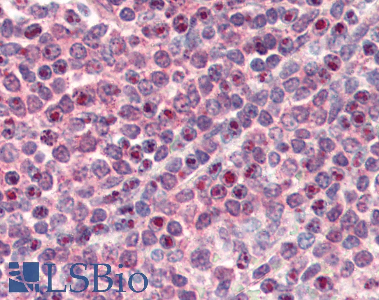 IHC-plus™ NR1H2 / LXR Beta Antibody (aa2-15)