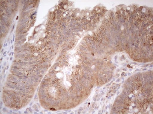 ZNF69 Antibody (clone OTI3C3)