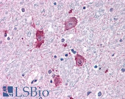 PathPlus™ NPY5R Antibody (Cytoplasmic Domain)