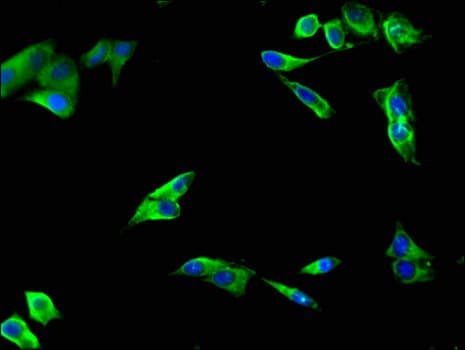 LIPG / Endothelial Lipase Antibody