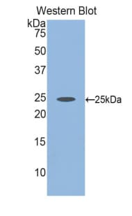 FBLN2 / Fibulin 2 Antibody (aa1013-1221)