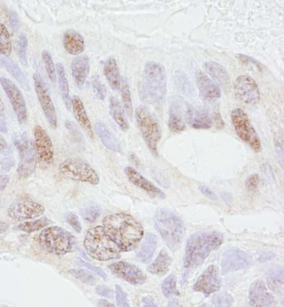 Polyclonal Rabbit anti-Human Prohibitin 2 / PHB2 Antibody (aa1-50, IHC)