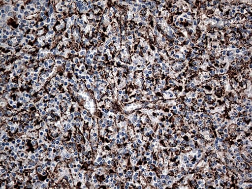 CTSL / Cathepsin L Antibody (aa114-333, clone OTI5C8)