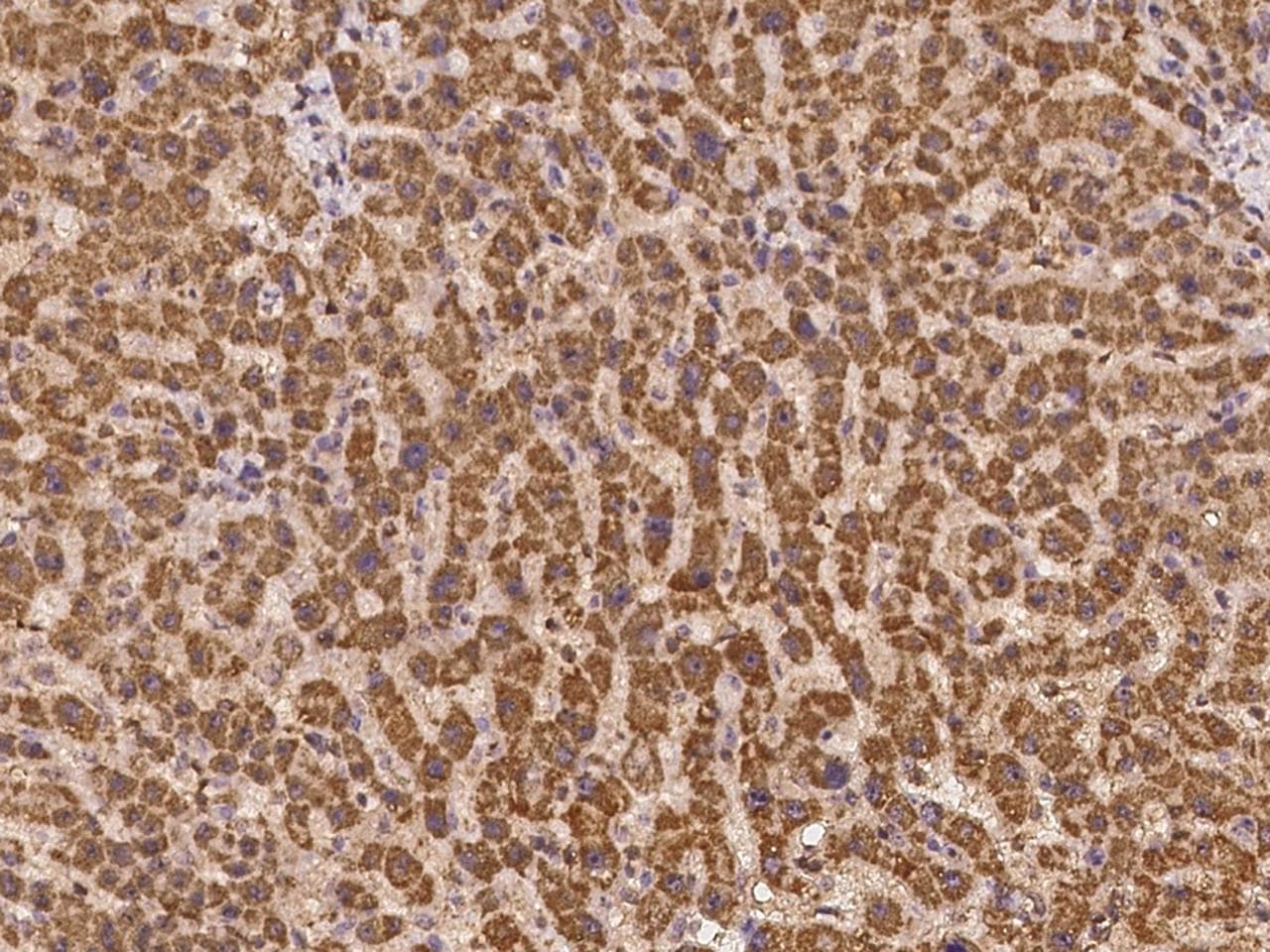TNFSF14 / LIGHT Antibody