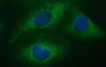 CD22 Antibody (clone OTI1F12)
