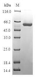 Human BLVRA Protein (Recombinant GST, N-terminus)