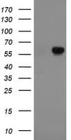 FTCD / 58K Golgi Protein Antibody (clone OTI1A7)