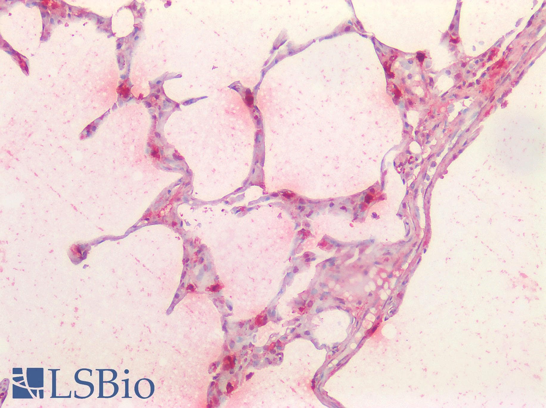 Monoclonal Mouse anti-Human TPSAB1 / Mast Cell Tryptase Antibody (clone C10, IHC, WB)