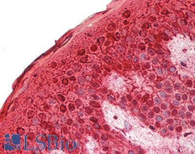 IHC-plus™ Polyclonal Rabbit anti-Human CALML5 Antibody (aa1-146, IHC, WB)