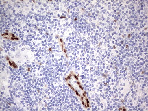 Monoclonal Mouse anti-Human MEOX1 Antibody (clone OTI2F4, IHC, WB)