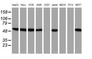 IHC-plus™ SNX8 Antibody (clone 4F8)