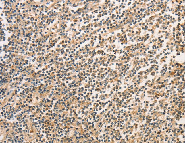 BCL2L14 / BCL-G Antibody