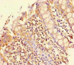 PEBP4 Antibody