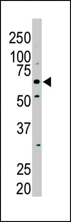 Polyclonal Rabbit anti-Human PKLR Antibody (aa1-30, IHC, WB)