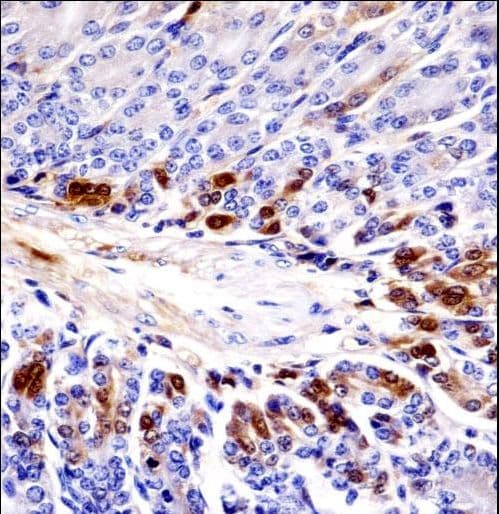 PEAK1 / SGK269 Antibody (aa1188-1216)