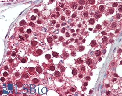 IHC-plus™ Polyclonal Rabbit anti-Human UBE1L2 / UBE1L2 Antibody (aa775-825, IHC, WB)