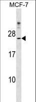CYB5D1 Antibody (aa59-86)