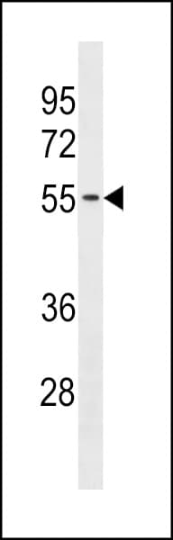 IHC-plus™ Polyclonal Rabbit anti-Human TMX3 Antibody (aa402-431, IHC, WB)