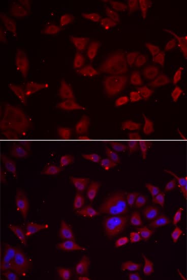 IHC-plus™ Polyclonal Rabbit anti-Human PFK2 / PFKFB3 Antibody (IHC, IF, WB)